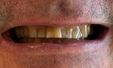 Bridge Results 